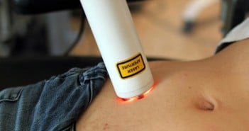 Laserbehandling mot infertilitet
